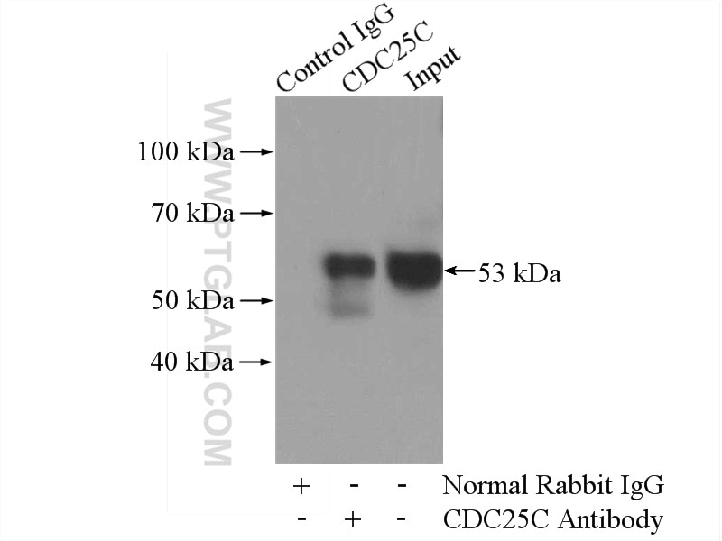 Immunoprecipitation (IP) experiment of K-562 cells using CDC25C Polyclonal antibody (16485-1-AP)