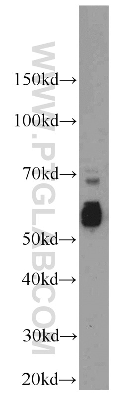 CDC25C Polyclonal antibody