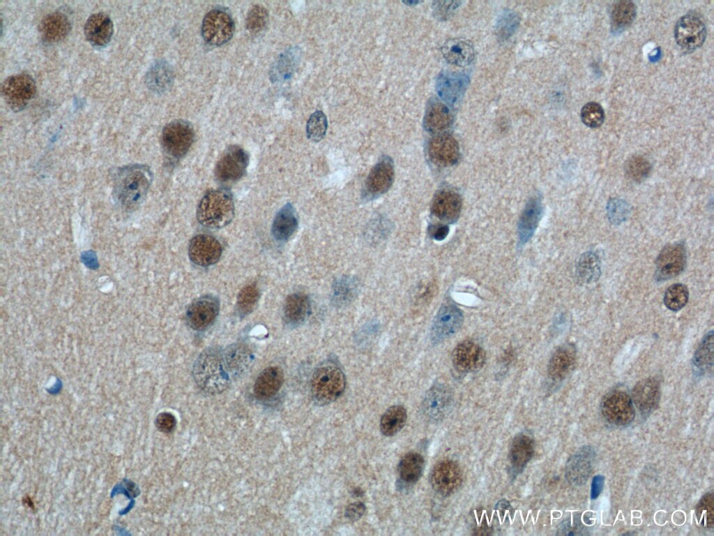 Immunohistochemistry (IHC) staining of mouse brain tissue using CDC26 Polyclonal antibody (14125-1-AP)