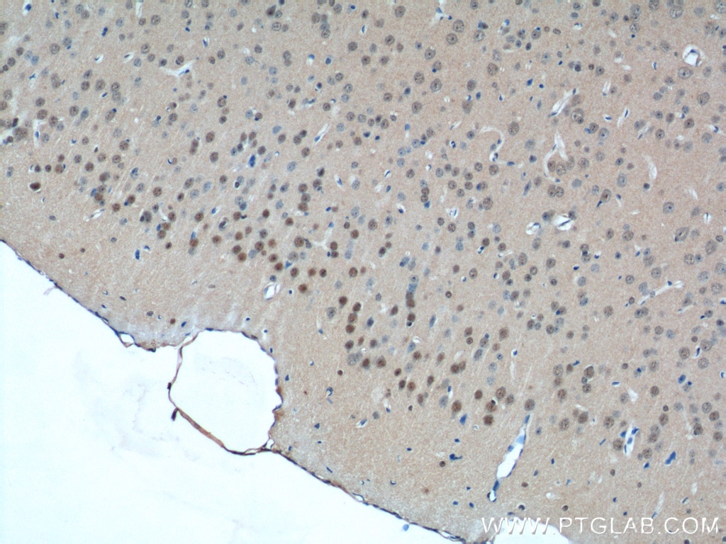 Immunohistochemistry (IHC) staining of mouse brain tissue using CDC26 Polyclonal antibody (14125-1-AP)