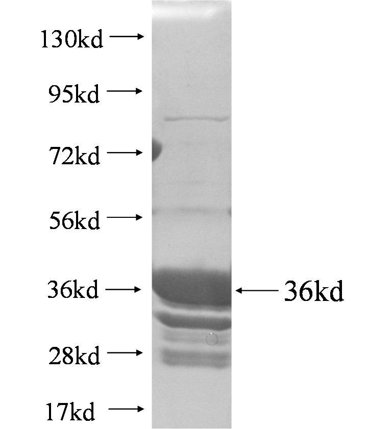CDC26 fusion protein Ag5276 SDS-PAGE