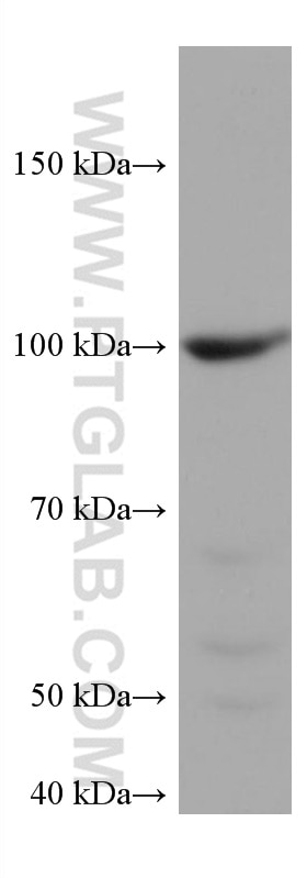 Western Blot (WB) analysis of 4T1 cells using CDC27; APC3 Monoclonal antibody (67239-1-Ig)