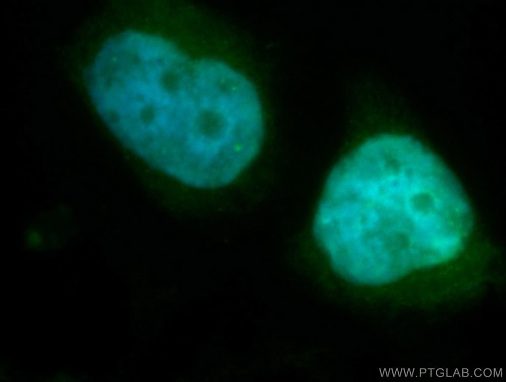 Immunofluorescence (IF) / fluorescent staining of SH-SY5Y cells using CDC27; APC3 Polyclonal antibody (10918-1-AP)