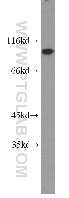 CDC27; APC3 Polyclonal antibody