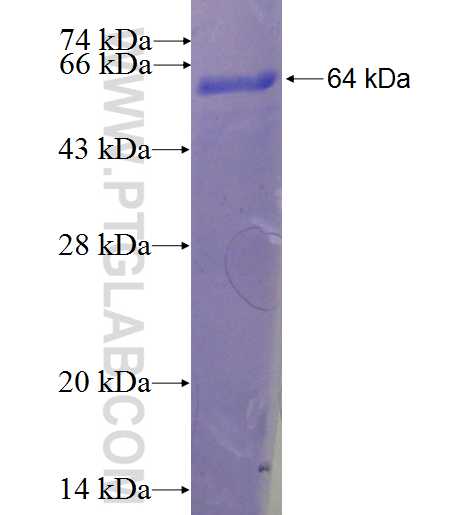 CDC27; APC3 fusion protein Ag1345 SDS-PAGE