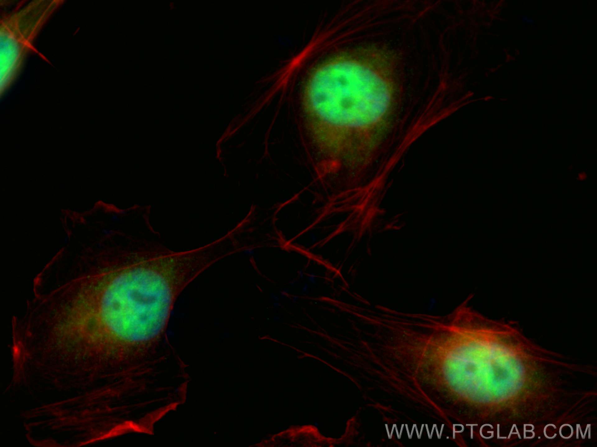 Immunofluorescence (IF) / fluorescent staining of HUVEC cells using CDC2L1 Polyclonal antibody (28613-1-AP)
