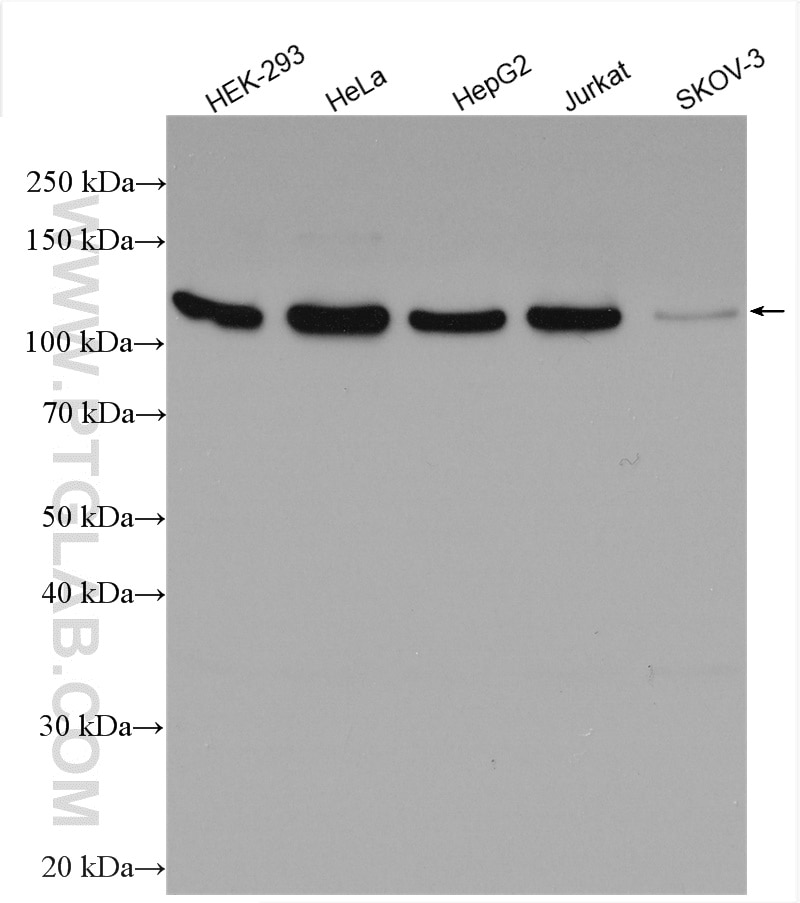 Western Blot (WB) analysis of various lysates using CDC2L1 Polyclonal antibody (28613-1-AP)