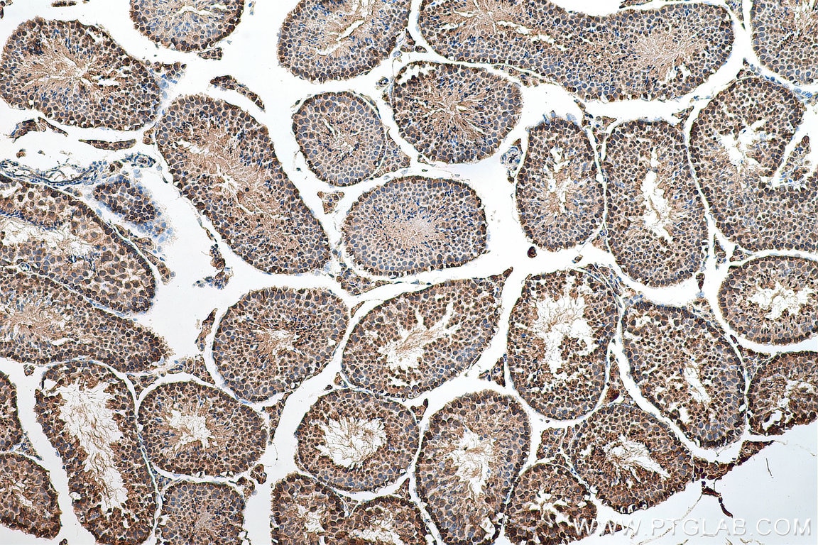 Immunohistochemistry (IHC) staining of mouse testis tissue using CDK8/19 Polyclonal antibody (13761-1-AP)
