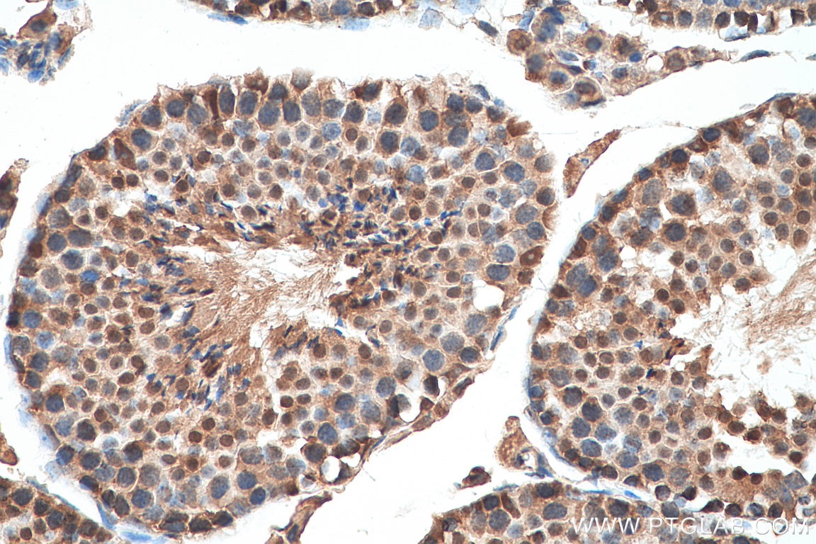 Immunohistochemistry (IHC) staining of mouse testis tissue using CDK8/19 Polyclonal antibody (13761-1-AP)