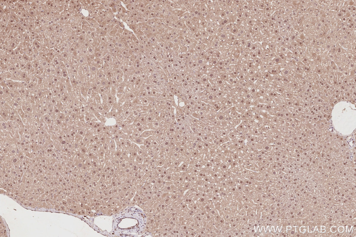 Immunohistochemistry (IHC) staining of mouse liver tissue using CDK8/19 Polyclonal antibody (13761-1-AP)
