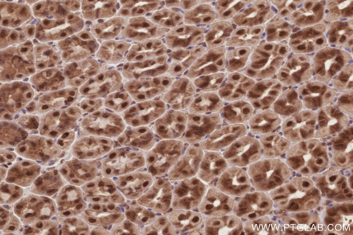 Immunohistochemistry (IHC) staining of mouse stomach tissue using CDK8/19 Polyclonal antibody (13761-1-AP)
