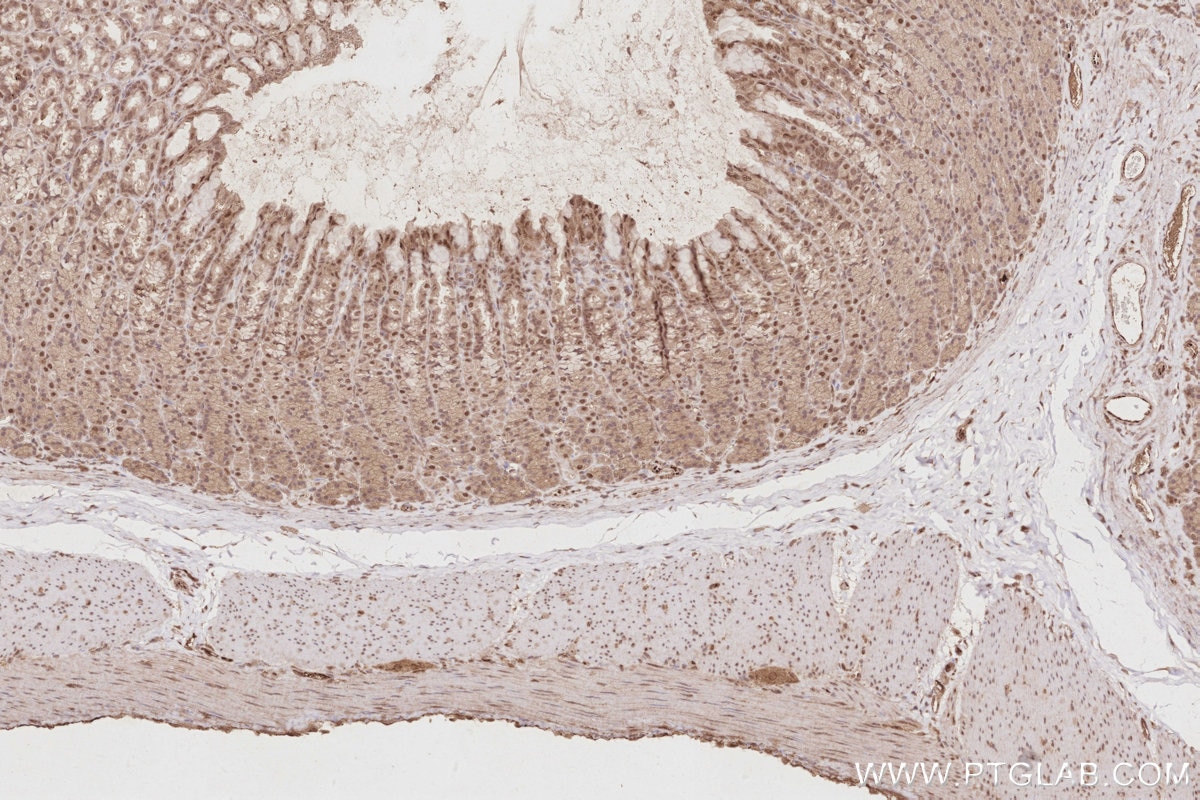 Immunohistochemistry (IHC) staining of rat stomach tissue using CDK8/19 Polyclonal antibody (13761-1-AP)