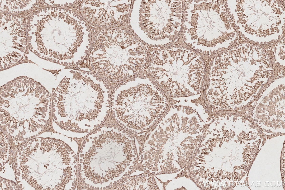Immunohistochemistry (IHC) staining of rat testis tissue using CDK8/19 Polyclonal antibody (13761-1-AP)