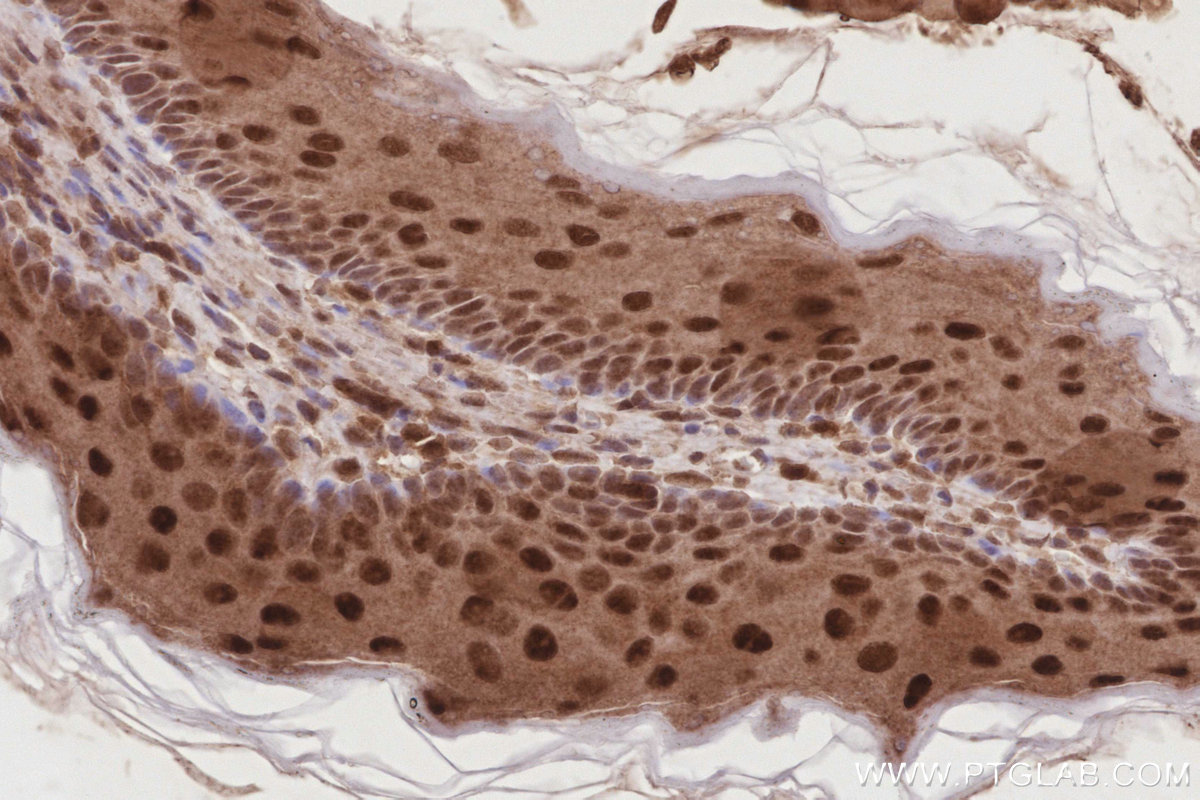 Immunohistochemistry (IHC) staining of mouse stomach tissue using CDK8/19 Polyclonal antibody (13761-1-AP)