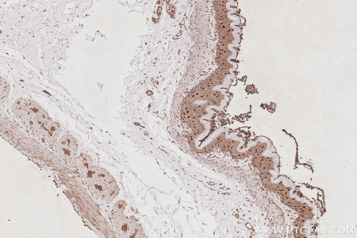 Immunohistochemistry (IHC) staining of rat stomach tissue using CDK8/19 Polyclonal antibody (13761-1-AP)