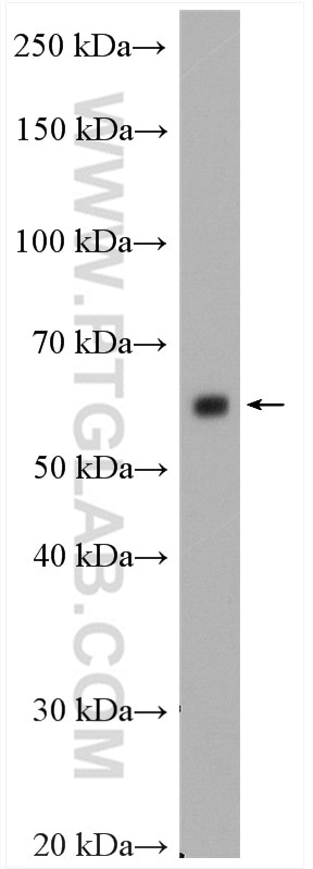 Western Blot (WB) analysis of mouse brain tissue using CDK8/19 Polyclonal antibody (13761-1-AP)