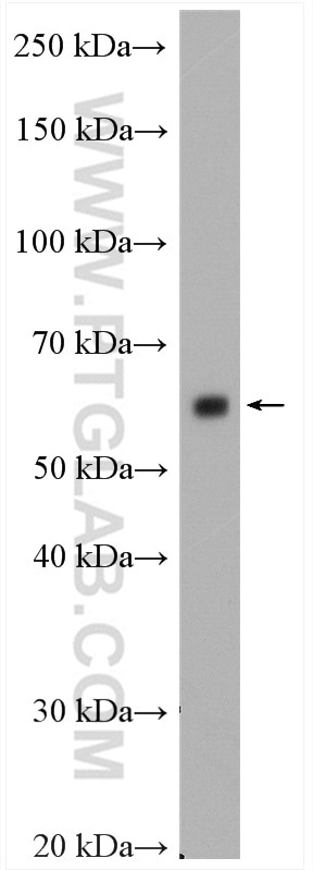 WB analysis of mouse brain using 13761-1-AP