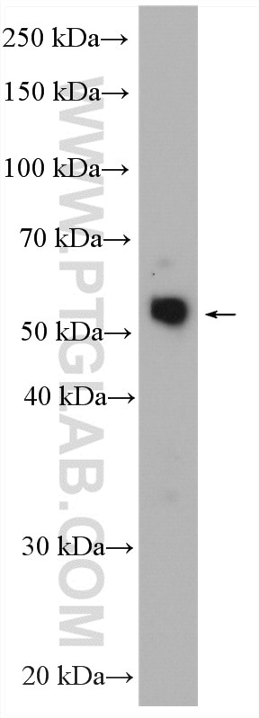 Western Blot (WB) analysis of Y79 cells using CDK8/19 Polyclonal antibody (13761-1-AP)