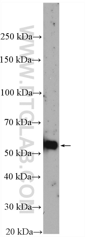 Western Blot (WB) analysis of Y79 cells using CDK8/19 Polyclonal antibody (13761-1-AP)