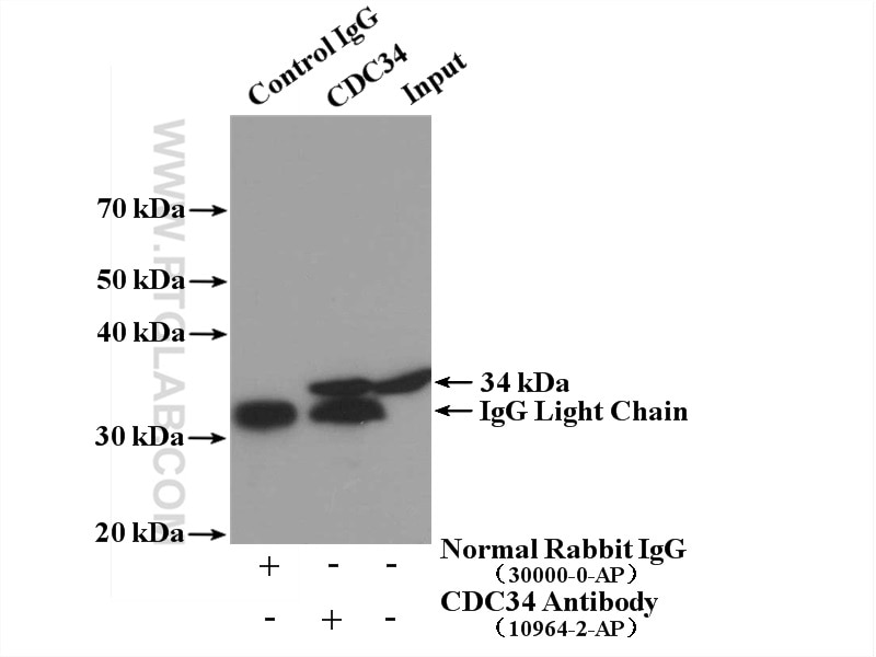Immunoprecipitation (IP) experiment of HEK-293 cells using CDC34 Polyclonal antibody (10964-2-AP)