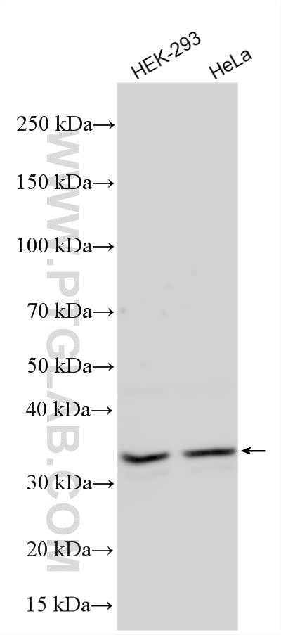 Various lysates were subjected to SDS PAGE followed by western blot with 10964-2-AP (CDC34 antibody) at dilution of 1:600 incubated at room temperature for 1.5 hours. Western Blot (WB) analysis of various lysates using CDC34 Polyclonal antibody (10964-2-AP)
