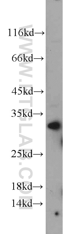 Western Blot (WB) analysis of human brain tissue using CDC34 Polyclonal antibody (10964-2-AP)