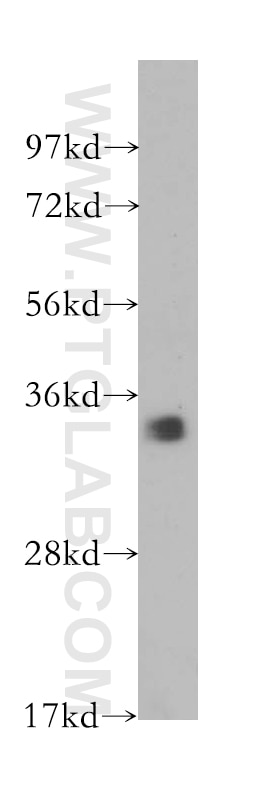 Western Blot (WB) analysis of human pancreas tissue using CDC34 Polyclonal antibody (10964-2-AP)