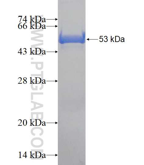 CDC34 fusion protein Ag1438 SDS-PAGE