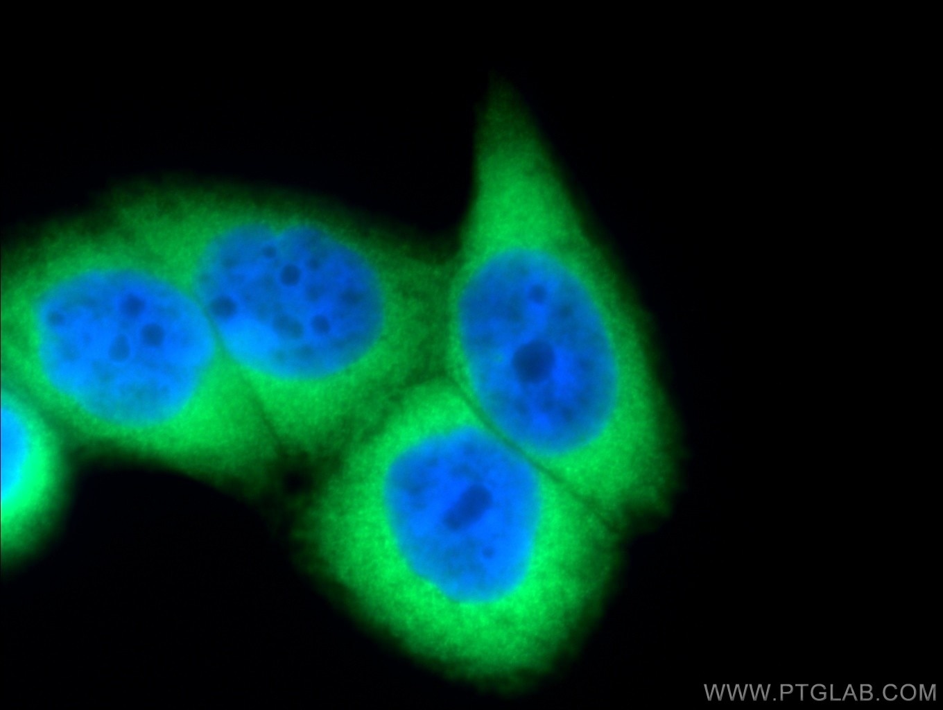 IF Staining of HeLa using 10218-1-AP