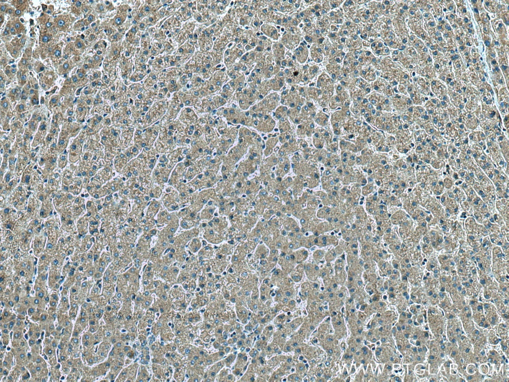 Immunohistochemistry (IHC) staining of human liver tissue using CDC37L1 Polyclonal antibody (16293-1-AP)