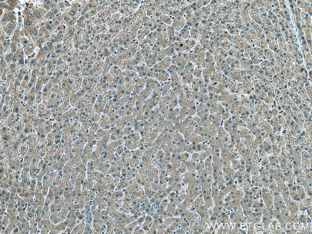 Immunohistochemistry (IHC) staining of human liver tissue using CDC37L1 Polyclonal antibody (16293-1-AP)
