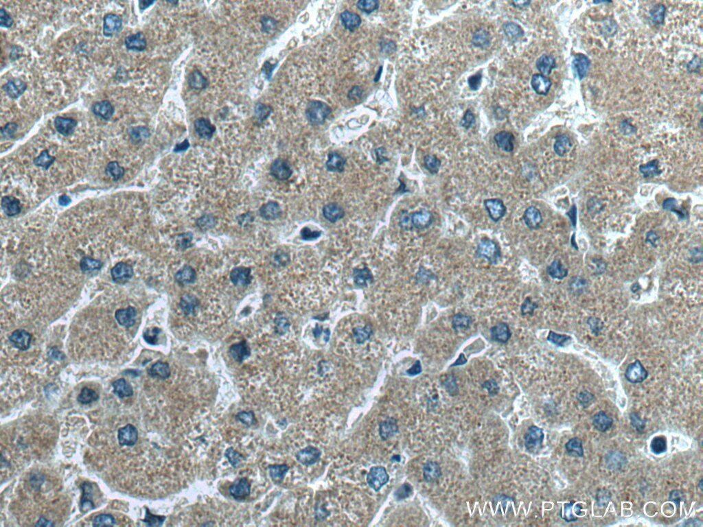 Immunohistochemistry (IHC) staining of human liver tissue using CDC37L1 Polyclonal antibody (16293-1-AP)