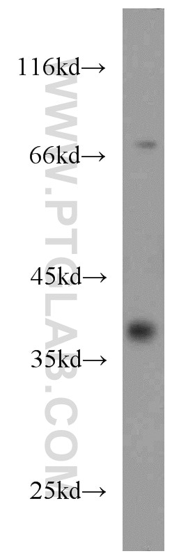 Western Blot (WB) analysis of human kidney tissue using CDC37L1 Polyclonal antibody (16293-1-AP)