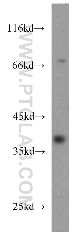 WB analysis of human kidney using 16293-1-AP