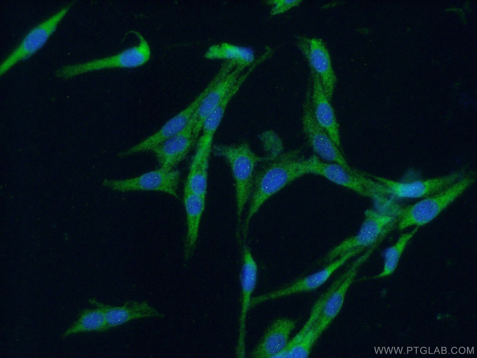 Immunofluorescence (IF) / fluorescent staining of C6 cells using CDC42 Polyclonal antibody (10155-1-AP)