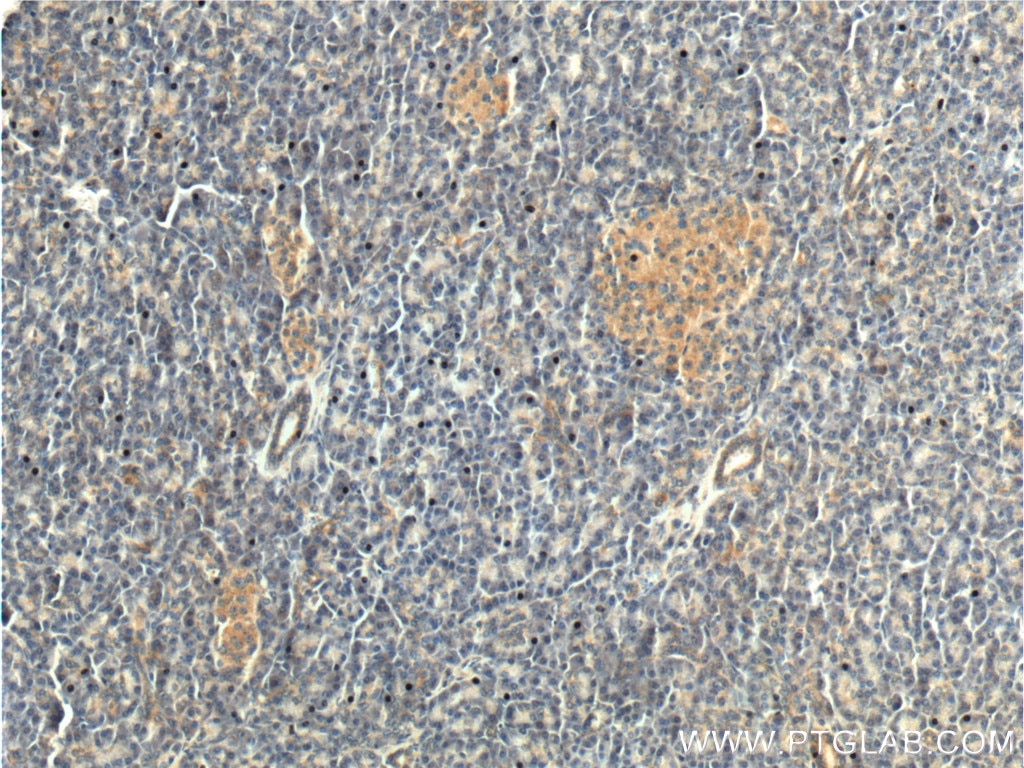 Immunohistochemistry (IHC) staining of human pancreas tissue using CDC42 Polyclonal antibody (10155-1-AP)