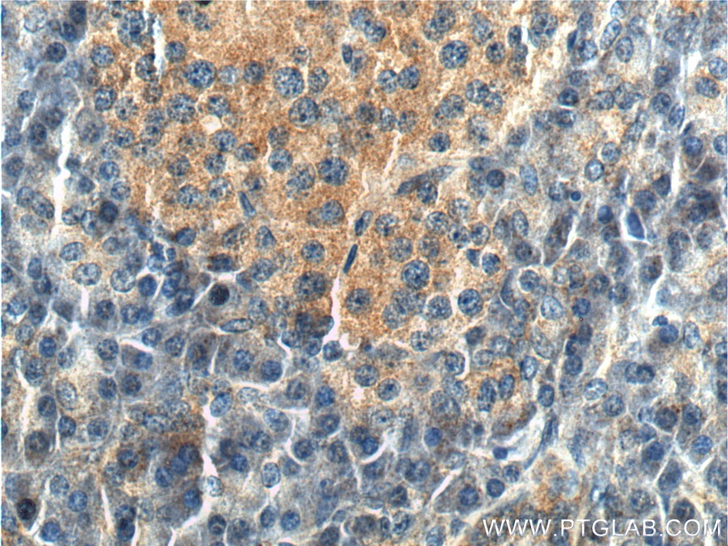 Immunohistochemistry (IHC) staining of human pancreas tissue using CDC42 Polyclonal antibody (10155-1-AP)