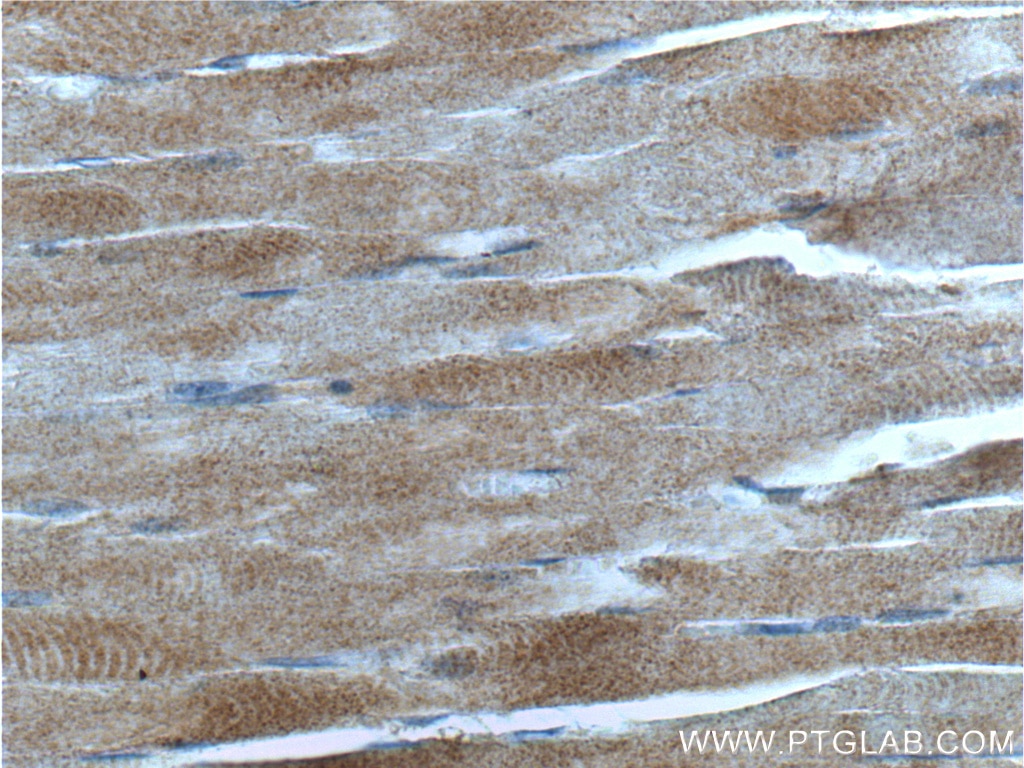 Immunohistochemistry (IHC) staining of human skeletal muscle tissue using CDC42 Polyclonal antibody (10155-1-AP)