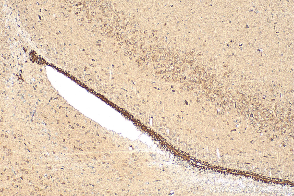Immunohistochemistry (IHC) staining of rat brain tissue using CDC42 Polyclonal antibody (10155-1-AP)