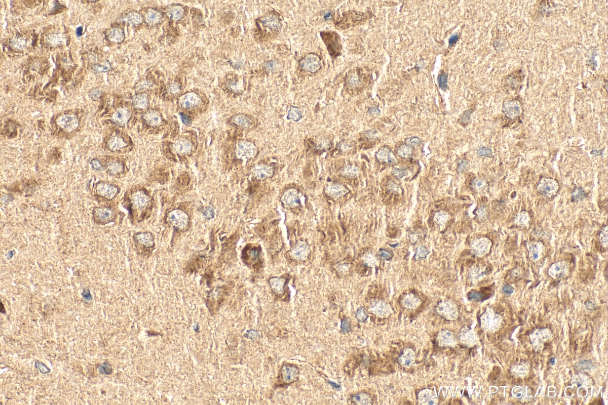 Immunohistochemistry (IHC) staining of rat brain tissue using CDC42 Polyclonal antibody (10155-1-AP)