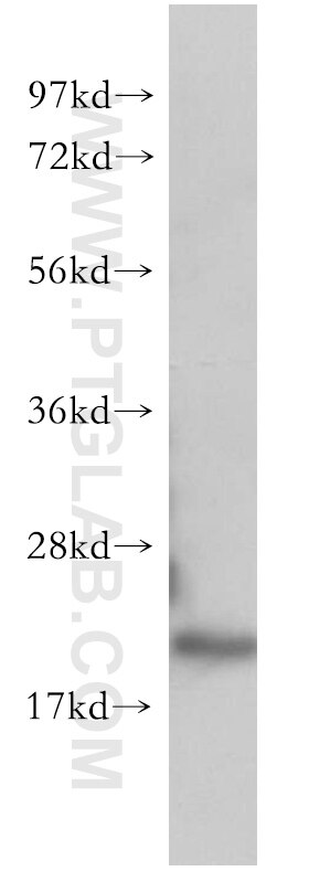 CDC42 Polyclonal antibody