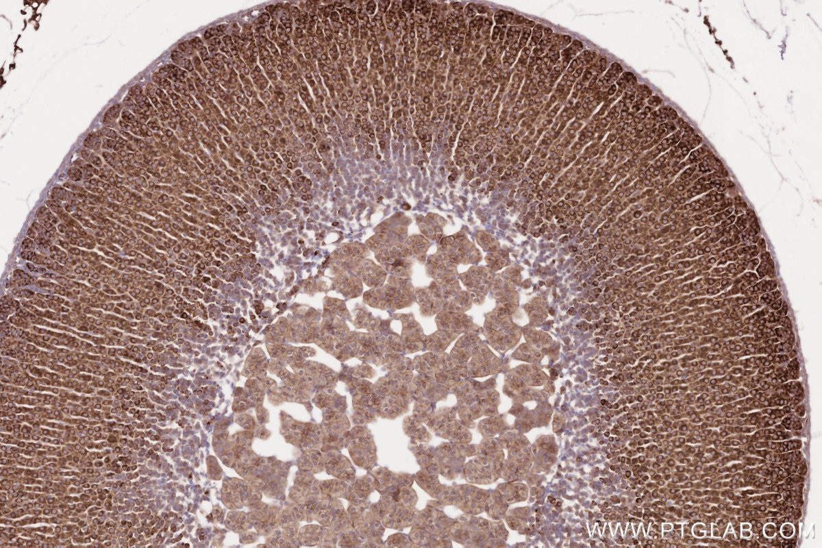 IHC staining of mouse adrenal gland using 31297-1-AP Immunohistochemistry (IHC) staining of mouse adrenal gland tissue using CDC42BPA Polyclonal antibody (31297-1-AP)