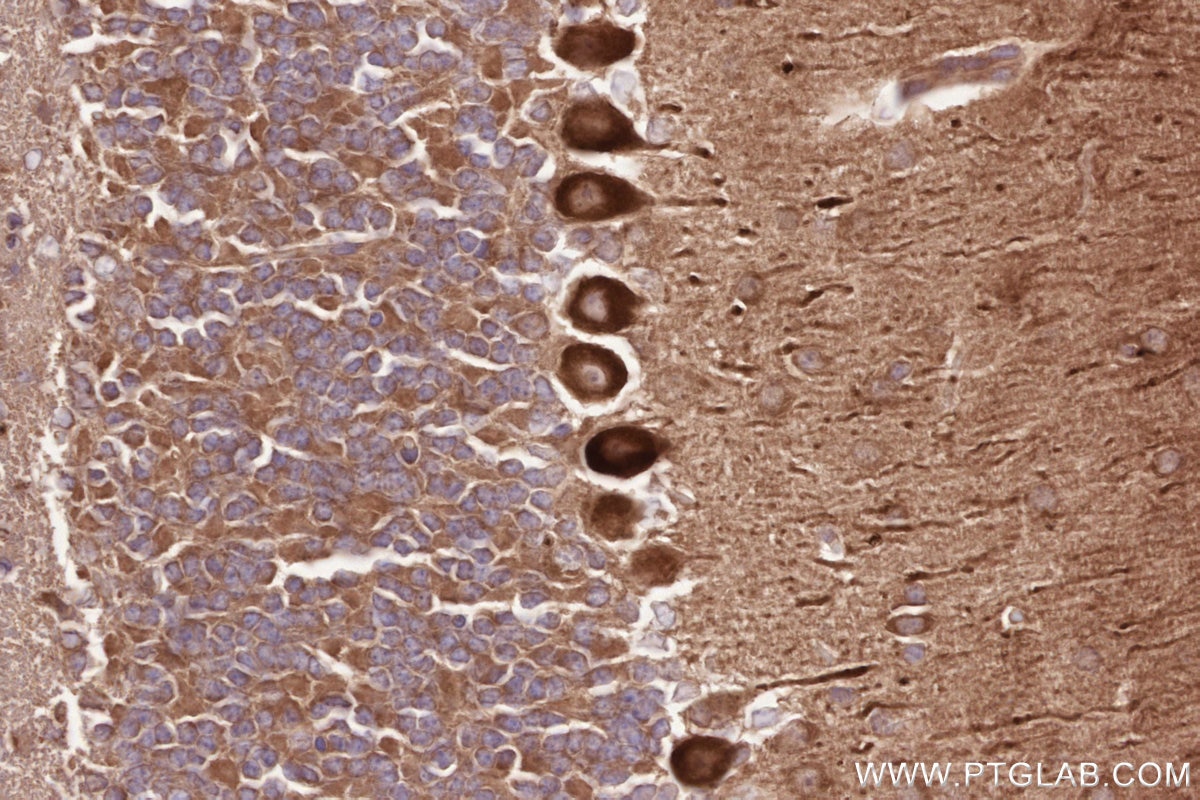 IHC staining of mouse cerebellum using 31297-1-AP Immunohistochemistry (IHC) staining of mouse cerebellum tissue using CDC42BPA Polyclonal antibody (31297-1-AP)