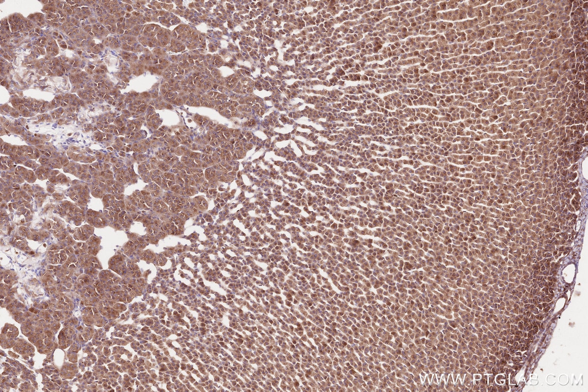 IHC staining of rat adrenal gland using 31297-1-AP Immunohistochemistry (IHC) staining of rat adrenal gland tissue using CDC42BPA Polyclonal antibody (31297-1-AP)