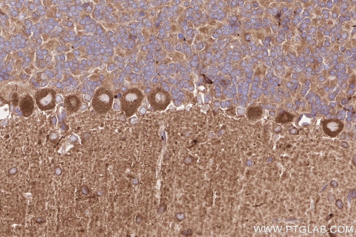 IHC staining of rat cerebellum using 31297-1-AP Immunohistochemistry (IHC) staining of rat cerebellum tissue using CDC42BPA Polyclonal antibody (31297-1-AP)