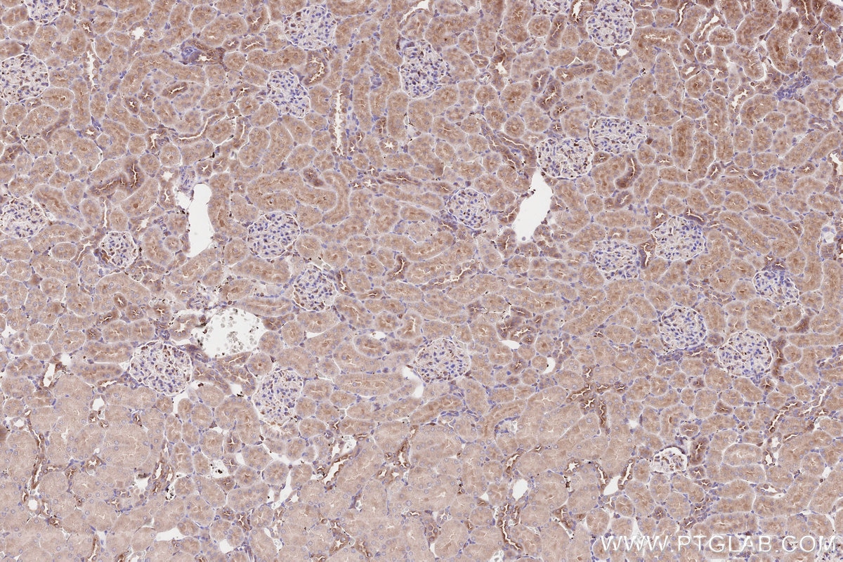 IHC staining of rat kidney using 31297-1-AP Immunohistochemistry (IHC) staining of rat kidney tissue using CDC42BPA Polyclonal antibody (31297-1-AP)