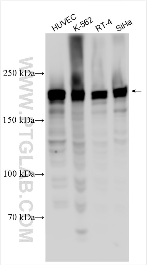 Western Blot (WB) analysis of various lysates using CDC42BPA Polyclonal antibody (31297-1-AP)