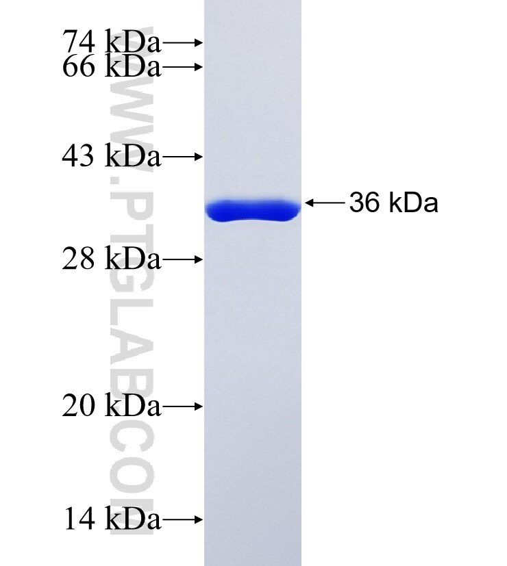 CDC42BPA fusion protein Ag34955 SDS-PAGE