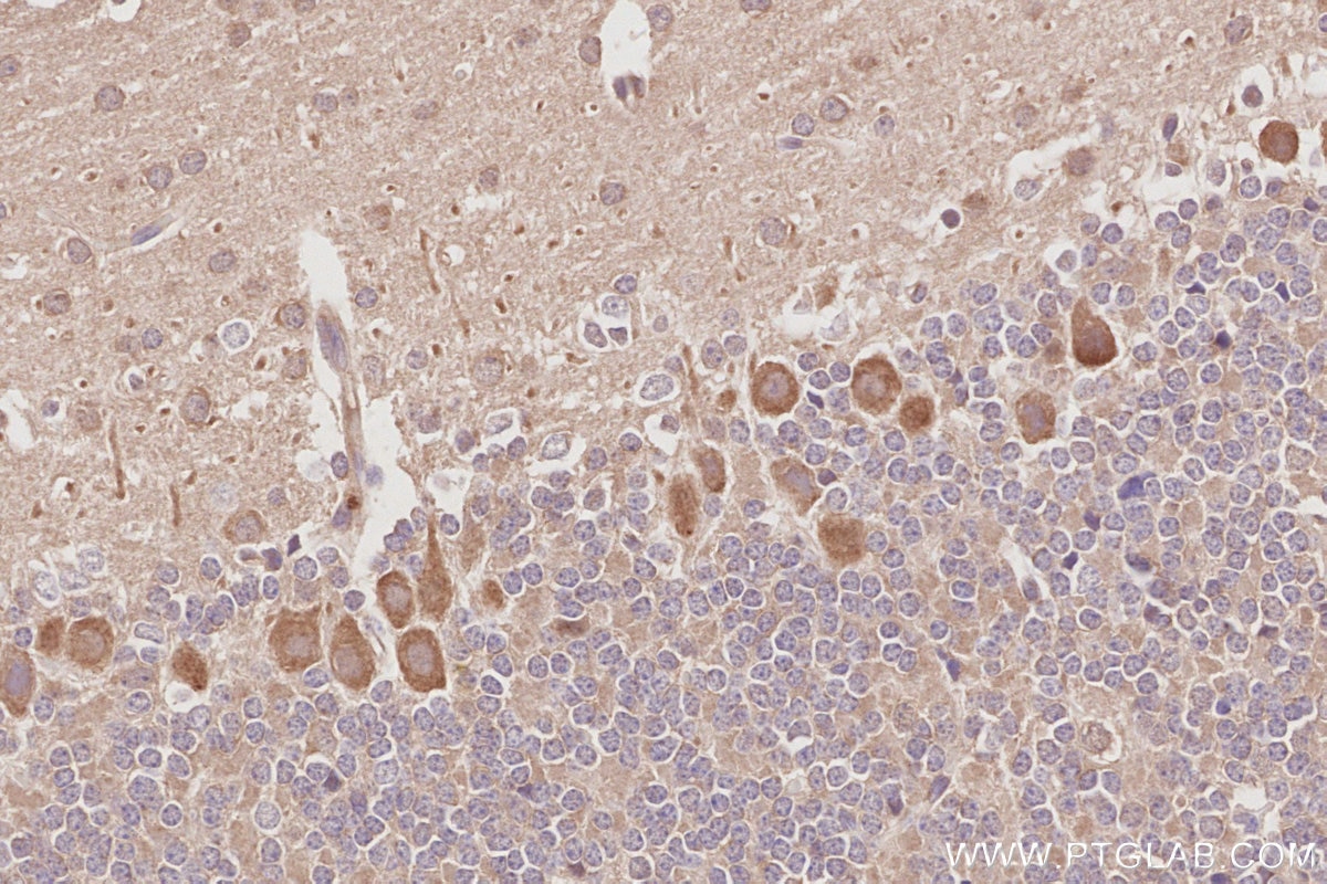 IHC staining of mouse cerebellum using 31526-1-AP Immunohistochemistry (IHC) staining of mouse cerebellum tissue using CDC42BPB Polyclonal antibody (31526-1-AP)