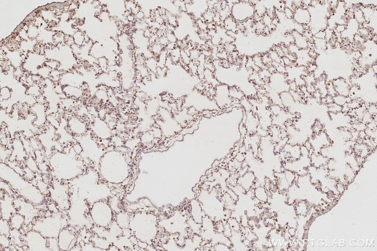 IHC staining of rat lung using 31526-1-AP Immunohistochemistry (IHC) staining of rat lung tissue using CDC42BPB Polyclonal antibody (31526-1-AP)